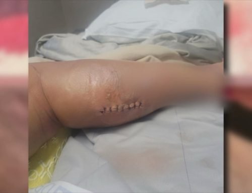 Mom says she was given days to live after spider-bite nightmare