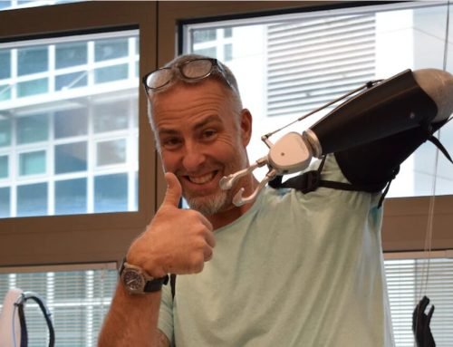 Marins Med provides new technology for amputees