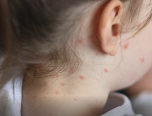 With US’s Measles-Free Status in Danger, ABC Fails to Mention Trump a…