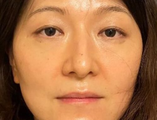 Dermatologist arrested after husband says she poisoned him